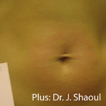 Forma Plus Before & After Patient #673